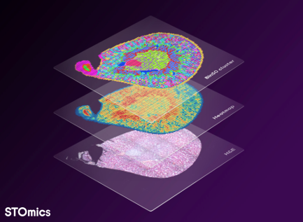 Stereo-seq Transcriptomics H&E Solution